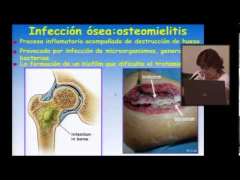 Utilización de nanopartículas cerámicas en la lucha contra el cáncer